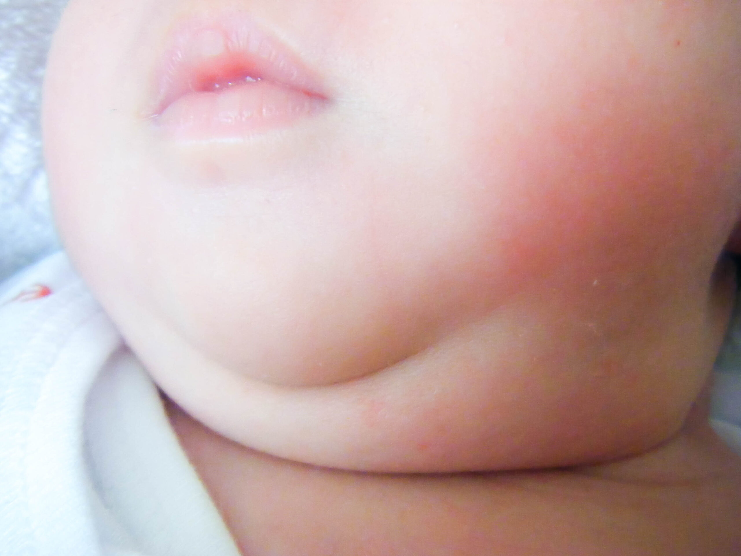 赤ちゃんの首と顎